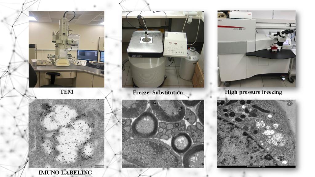 Advanced Preparation of Biological Samples for Transmission Electron Microscopy