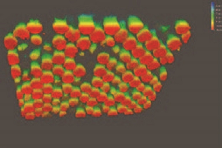 Retinal implant with photoreceptor precursors integrated within microwells.