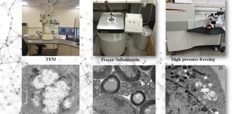 Advanced Preparation of Biological Samples for Transmission Electron Microscopy