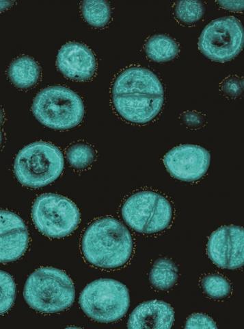 TEM micrographs of S. aureus (cyan) treated with the synthesized nano-particles (yellow). The nano particles target bacteria and mark them for destruction.