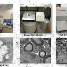 Advanced Preparation of Biological Samples for Transmission Electron Microscopy