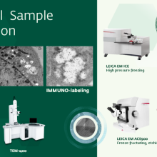 Advanced Preparation of Biological Samples for Transmission Electron Microscopy