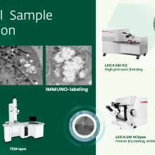 Characterization Unit, MIXA - Advanced Preparation of Biological Samples for Transmission Electron Microscopy